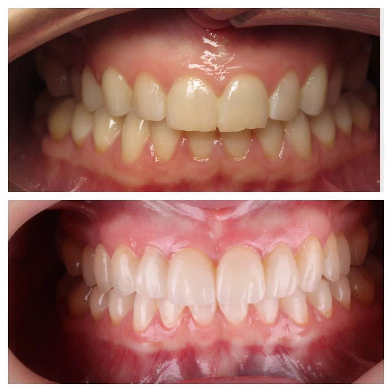An already-good smile, made intentional.
